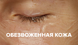 Обезвоженная кожа